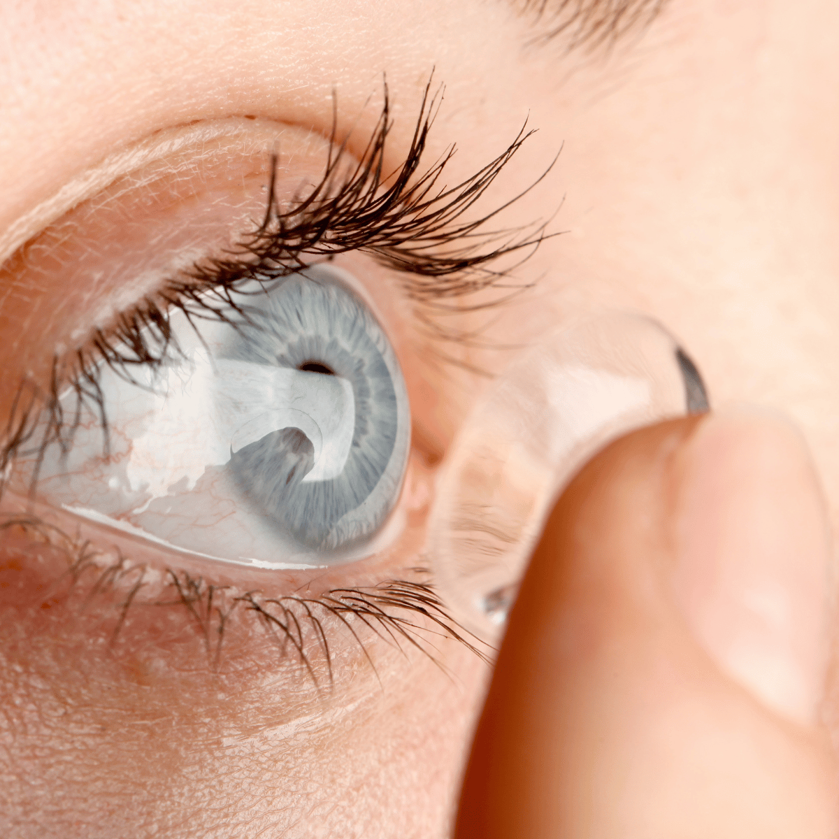Eye Lens